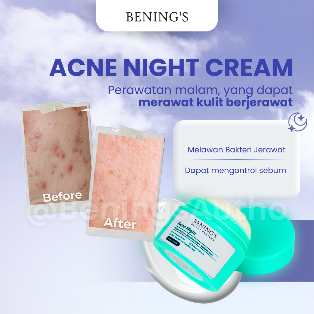 Bening Skincare Acne Night Cream Krim Malam Penghilang Jerawat Benings Skincare Memudarkan Wajah Ber