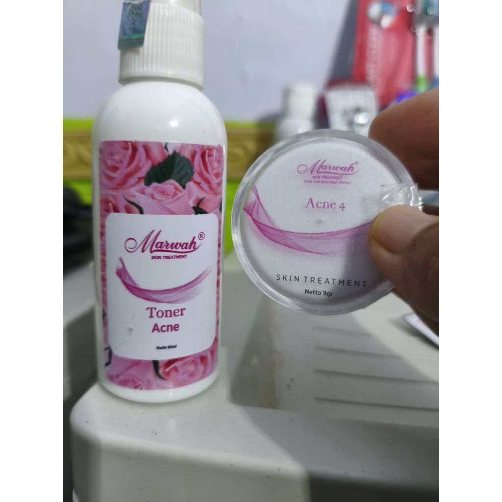 Ecer krim malam marwah acne