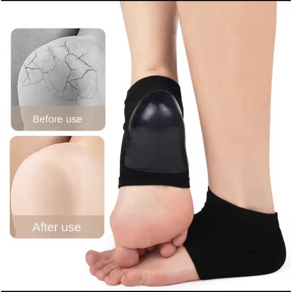 Pelindung Tumit Bantalan Kaki Tumit Insole Gel Silicon Sepatu Wanita - Tumit 01