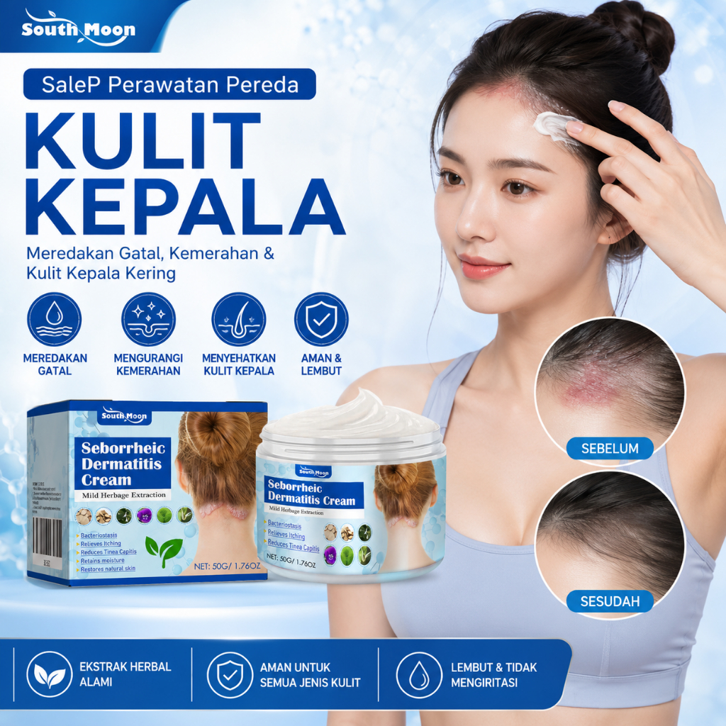 South Moon Seborrheic Dermatitis Cream 50g Seborrheic Skin Cream Krim Obat Kulit Kepala Psoriasis Ob