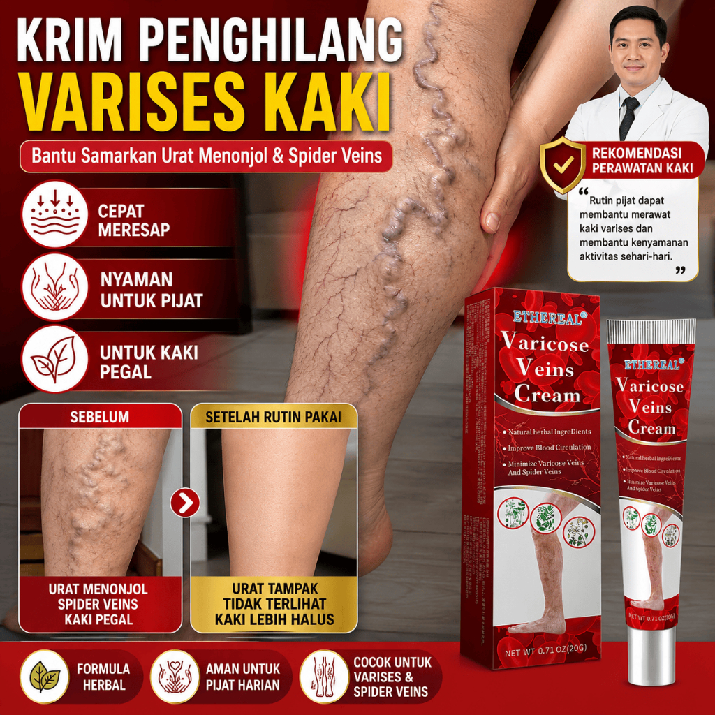 Krim Varises Kaki Urat Menonjol 20g Varicose Veins Cream Salep Varises Betis Spider Veins Kaki Pegal