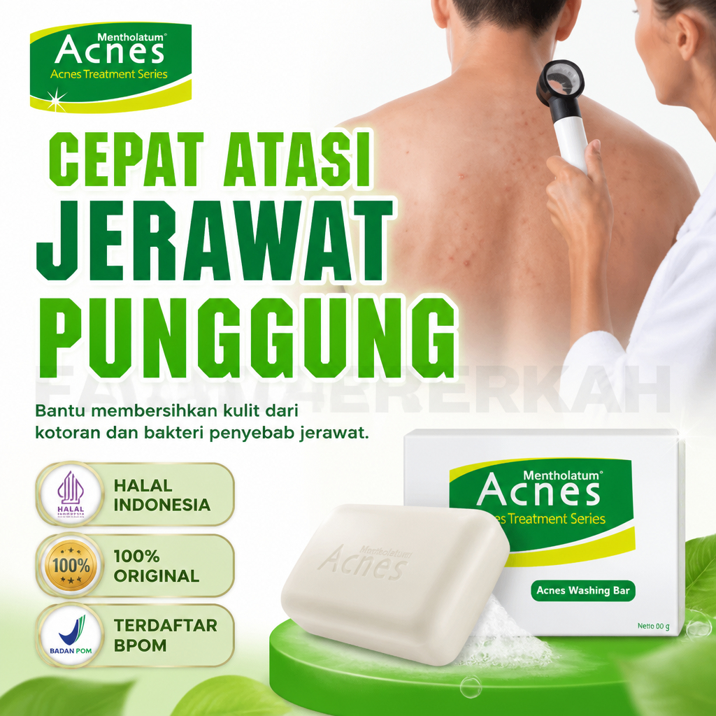 Sabun Jerawat Punggung - Obat Jerawat Punggung Merah - Penghilang Bekas Jerawat Punggung Hitam