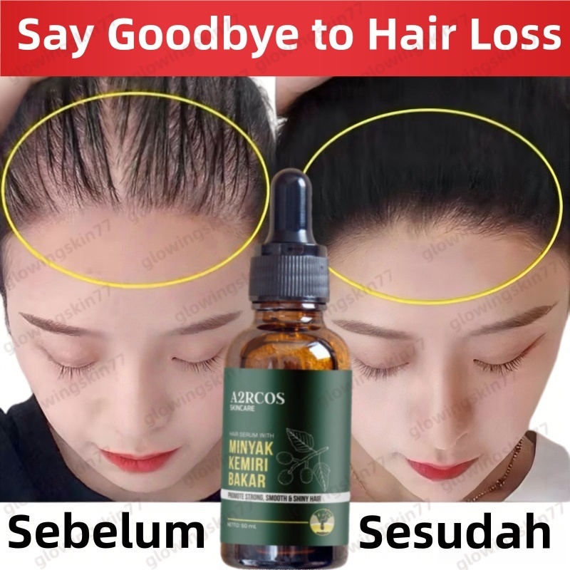 A2RCOS-Minyak Kemiri Bakar 100 ml -  Hair oil serum growth rambut anti rontok kering bercabang | Pen