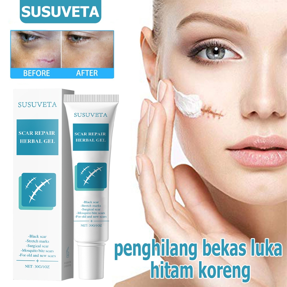 Penghilang bekas luka hitam koreng Bio herbal penghilang bekas luka Obat keloid Salep keloid paling 