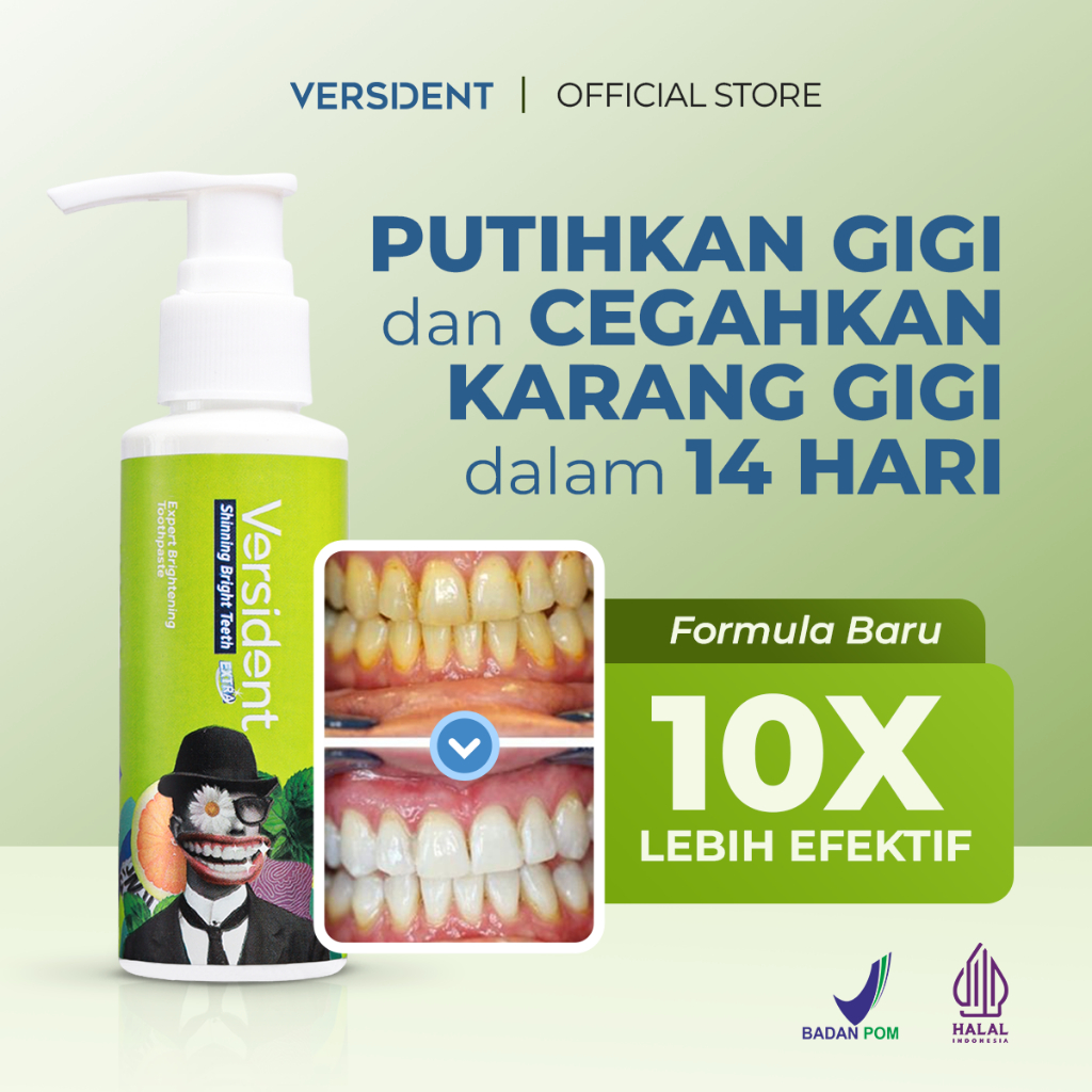 Pasta Gigi Versident Shining Bright Teeth 100g - Memutihkan Gigi, Mencegah Karang, Aroma Segar