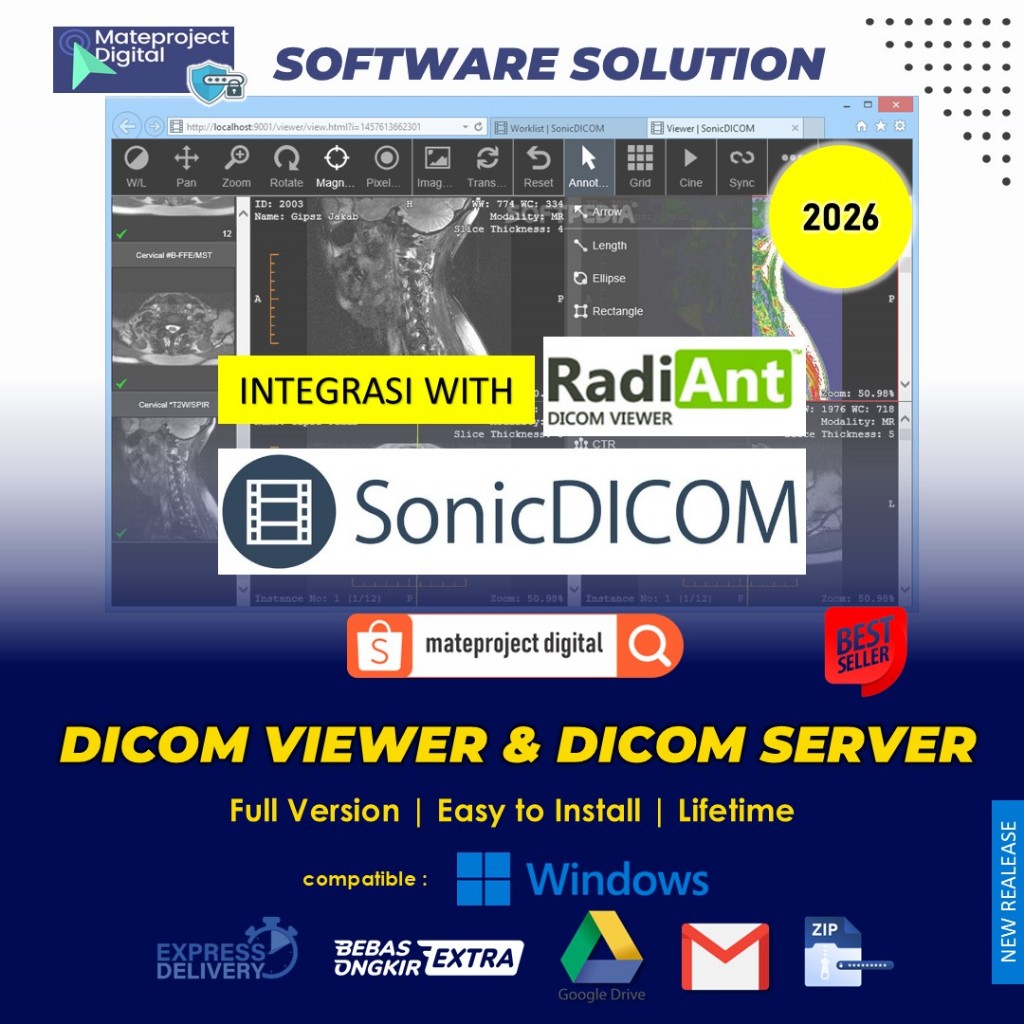SonicDicom Viewer 2026 License Key Full Software PACS DICOM Viewer & DICOM Server RadiAnt Dicom View