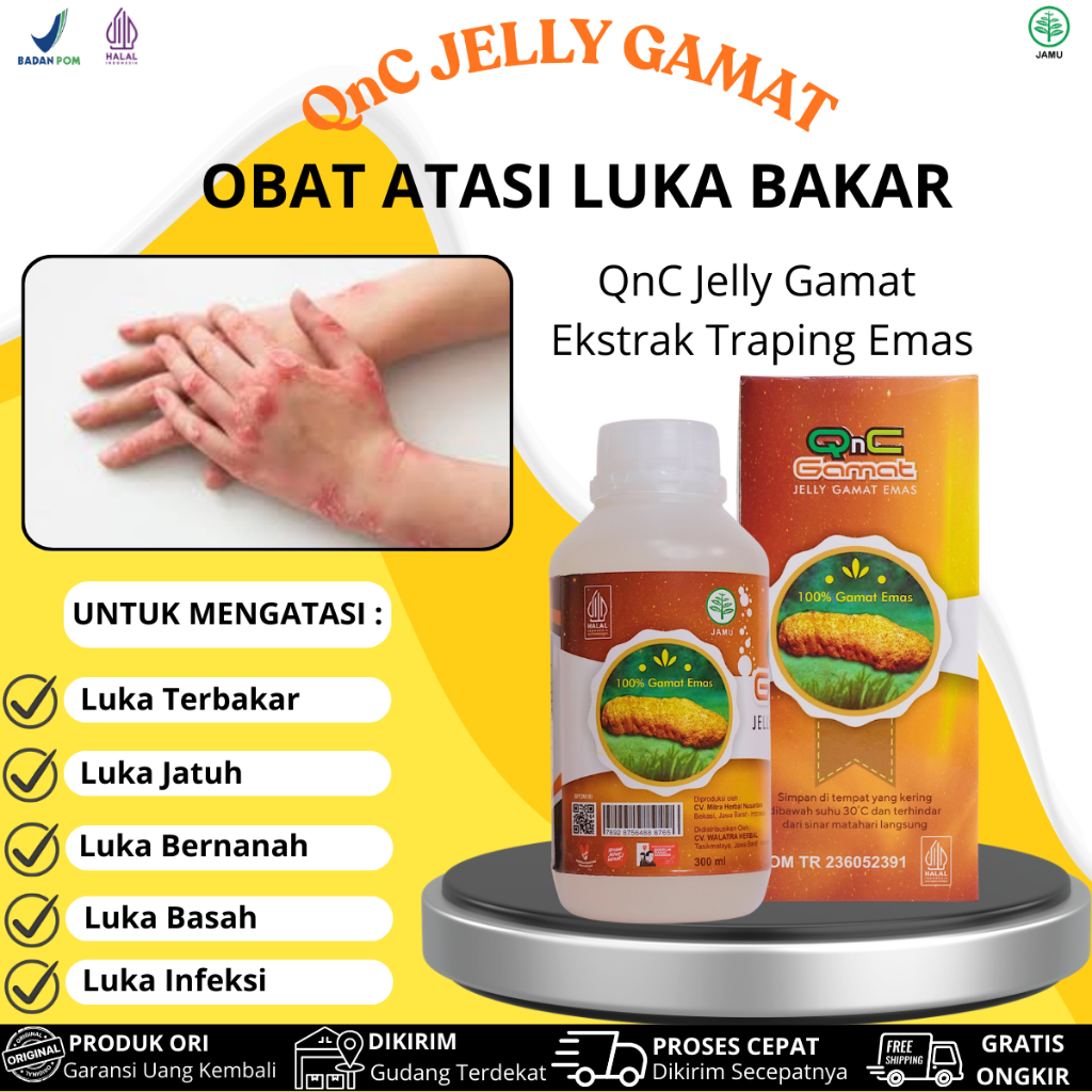 Obat Pengeringan Luka Bakar, Kulit Terbakar, Luka Basah, Luka Jatuh, Luka Bernanah, Luka Habis Opera