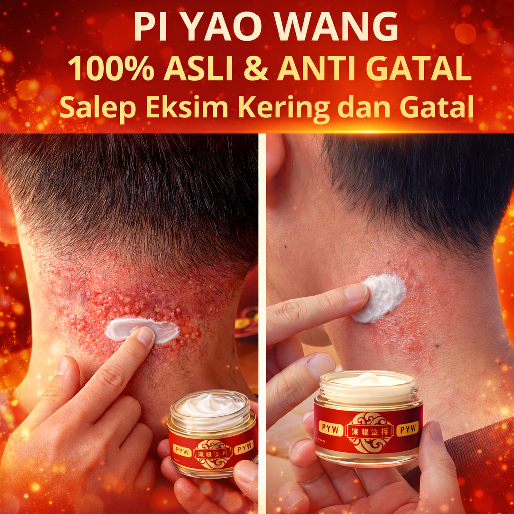Piyaowang Salep Gatal Cina Original Obat Eksim Jamur Sengkangan Kurap Scabies Panu Kadas Kudis Ori