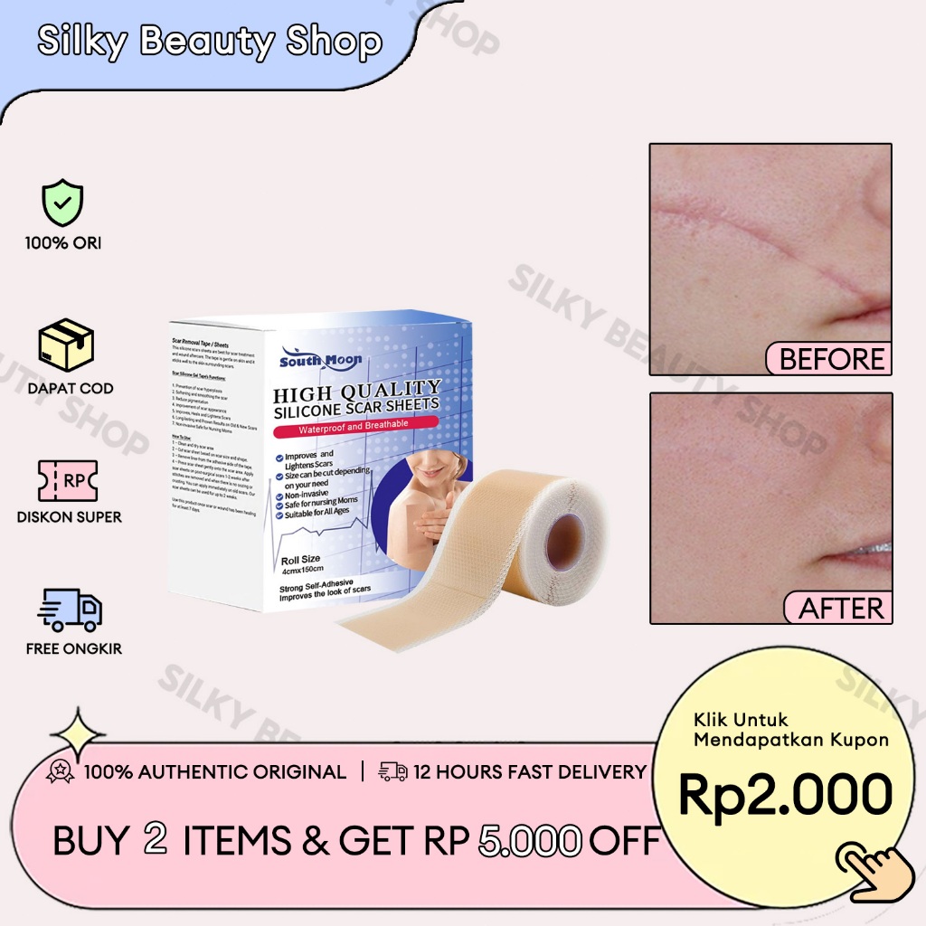 South Moon Tempel Bekas Luka Silikon 4cm*150cm Dermaline Silicone Keloid Silicone Scar Patch Plester