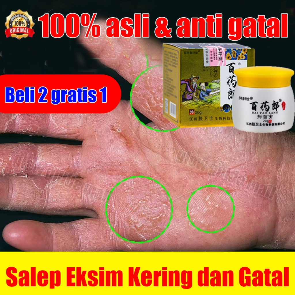 salep gatal kulit yang ampuh salep gatal bayi dan gatal selangkangan salep miss v gatal dan perih Me