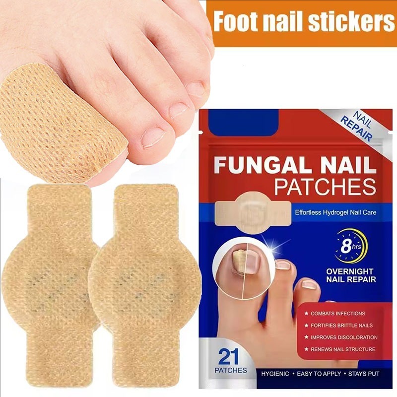 Obat jamur kuku Obat kuku cantengan Kuku berjamur dan rusak Jamur kuku kaki Nail Fungus Treatment Pe