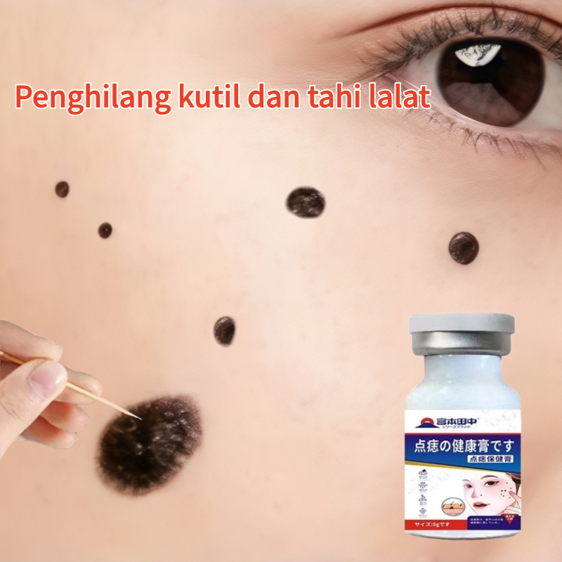Penghilang tahi lalat Kutil dan tahi lalat penghilang Skin tag remover Penghilang tahi lalat di waja