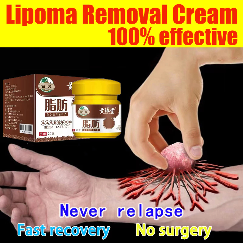 Obat Lipoma Salep Cina 30 gram Perawatan Punggung Leher Paha Kanker Tumor Tiroid Lipoma 30 gram