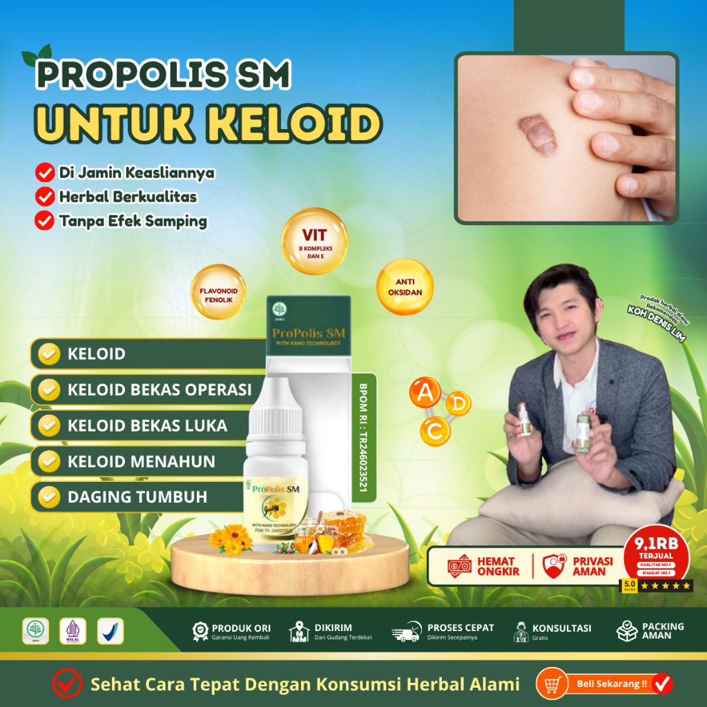 Penghilang Keloid Bekas Luka - Penghilang Keloid Menahun - Obat Keloid Bekas Luka Operasi