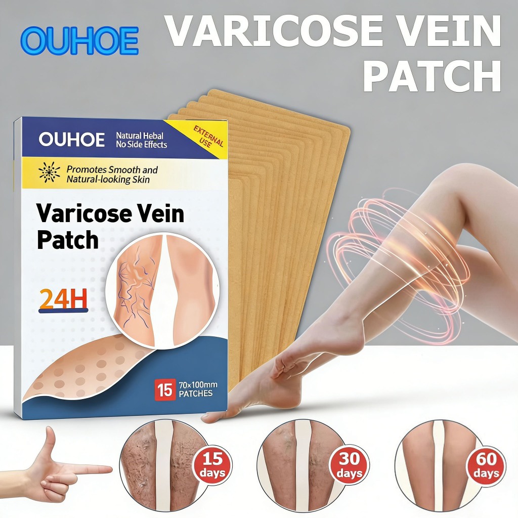 OUHOE Koyo Varises Penghilang Varises Di Kaki Varicose Patch Obat Varises Herbal Koyo Varicose 15pcs