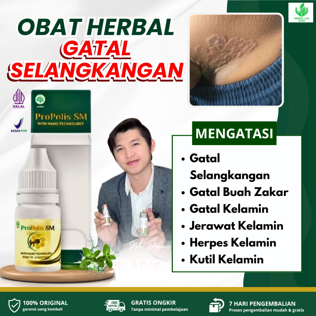 Propolis SM Obat Oles Gatal Selangkangan, Jamur Selangkangan, Kurap Selangkangan, Selangkangan Lecet