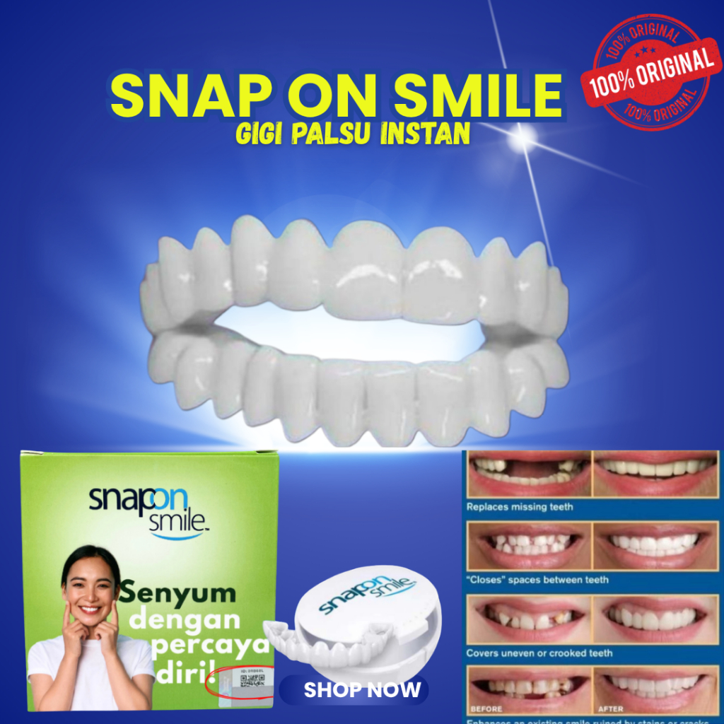 SUPER KUAT Snap On Smile Veneers Gigi Palsu Snap On Smile Atas Bawah 100% Original