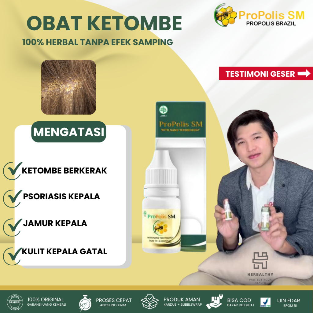 Obat Ketombe Parah Menahun, Obat Tetes Ketombe Parah, Obat Kulit Kepala Berkerak, Obat Ketombe Berke