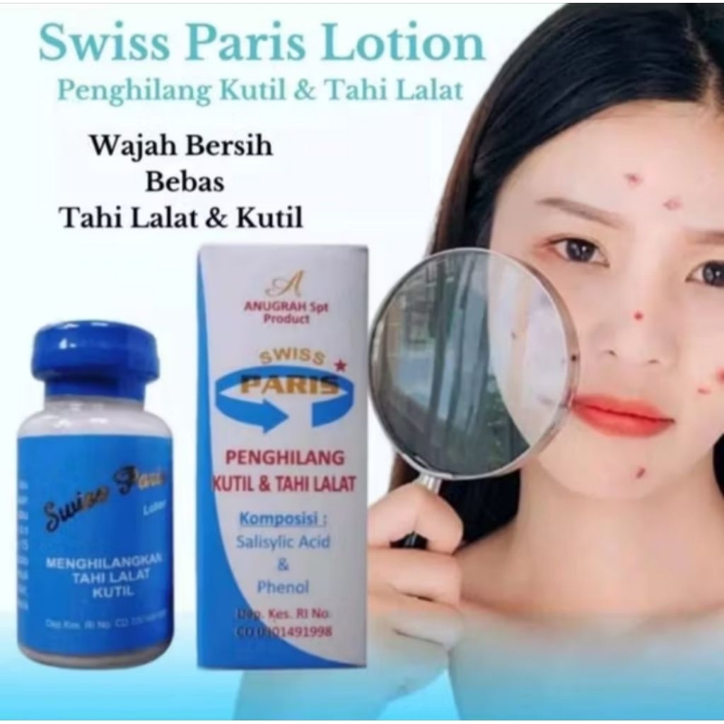 Swiss Paris Penghilang Tahi lalat dan kutil Original 100% obat penghilang tahi lalat dan kutil perma