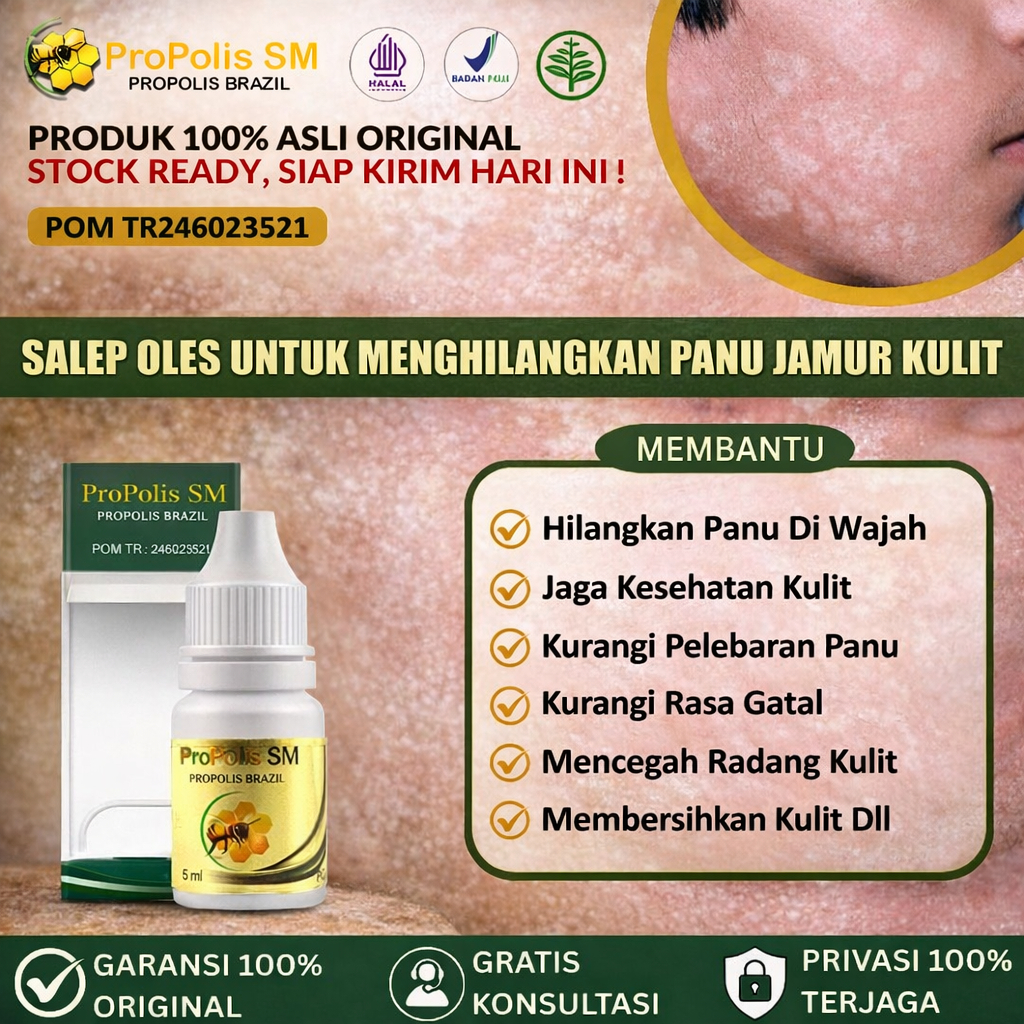 Obat Hapur Kulit, Bercak Putih Di Wajah, Penghilang Panu Di Wajah, Obat Oles  Penghilang Balas Bogo 
