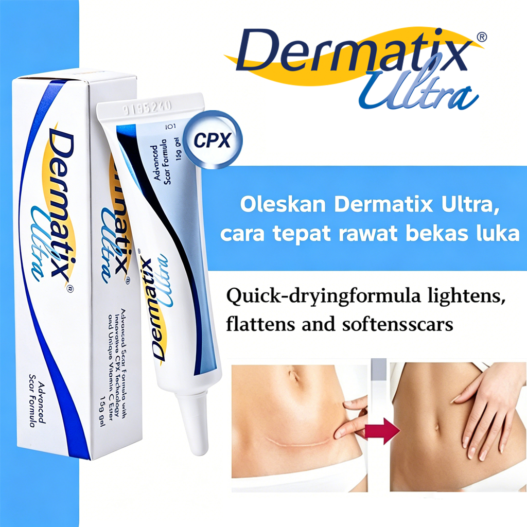 Dermatix Ultra Gel 15gr Penghilang Bekas Luka Jerawat Luka Operasi Luka Bakar Stretch Mark Asli Orig