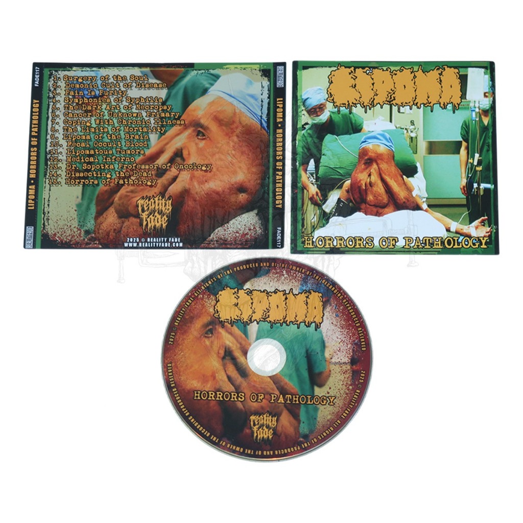 CD - Lipoma - Horrors Of Pathology