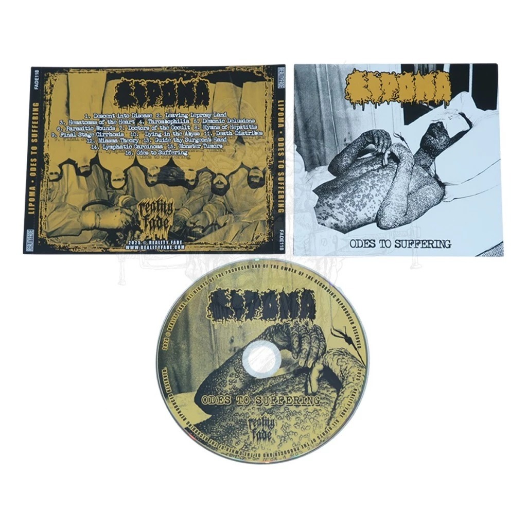 CD LIPOMA