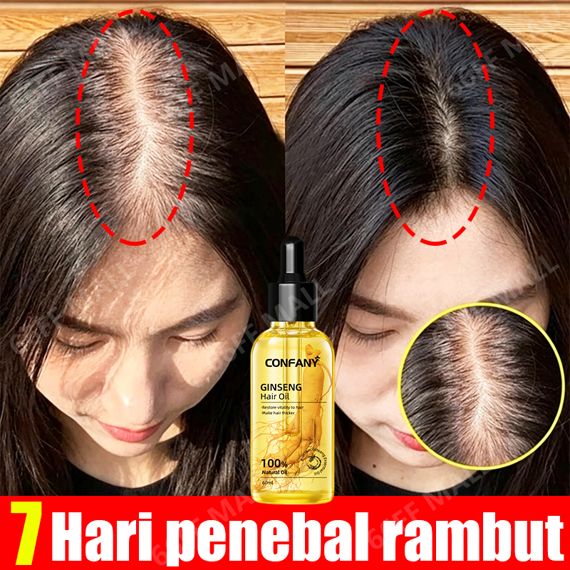 BPOM ginseng penumbuh rambut 60ml penumbuh rambut cepat dan tebal hair serum rambut rontok penumbuh 