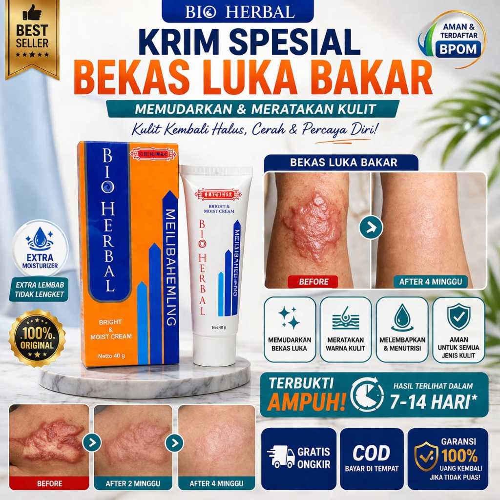 Meilibahenling Cream Penghilang Bekas Luka Bakar Penghilang Luka Keloid Ampuh