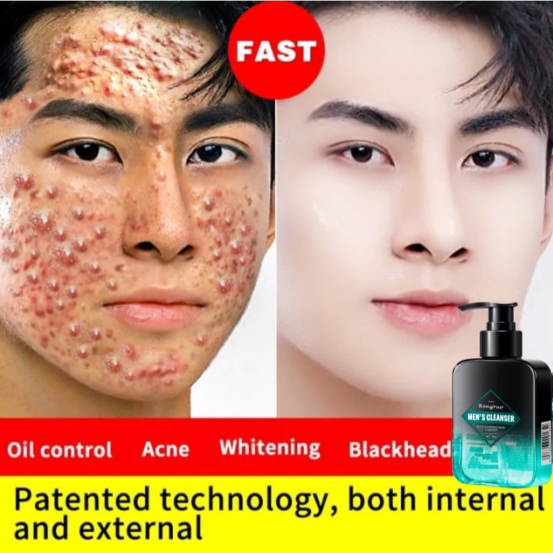 Perawatan wajah pria Pembersih Wajah penghilang jerawat pria Untuk Facial Cleanser 160g sabun cuci m