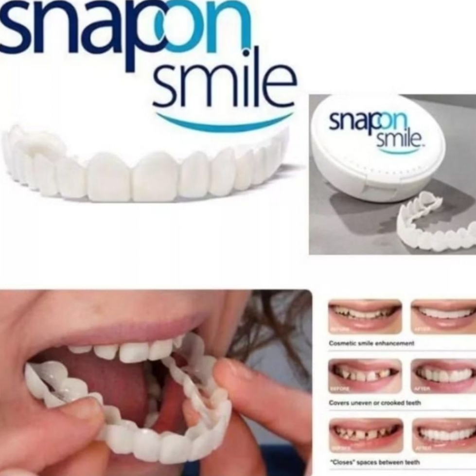 !READY STOK! Snap On Smile Veneer Instan Gigi Palsu Tiruan Kesehatan Mulut ~ramaolshop_23