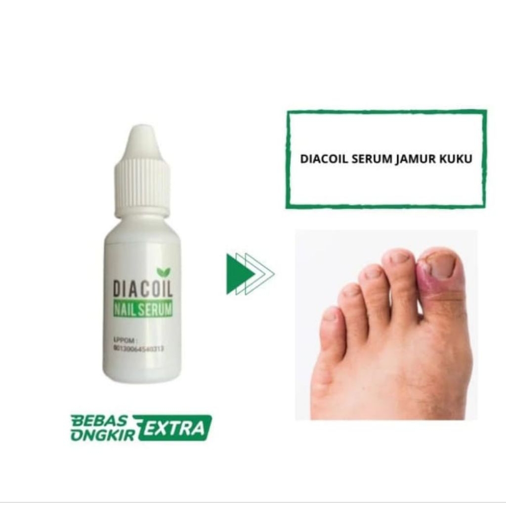 DIACOIL NAIL SERUM Obat Jamur Kuku Rusak Cantengan Bengkak Bernanah Menghitam