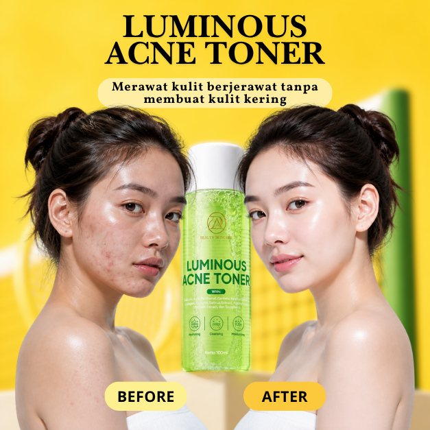 D&A BEAUTY SKINCARE TONER JERAWAT-LUMINOUS ACNE TONER-MENENANGKAN&MENGHIDRASI KULIT BERJERAWAT