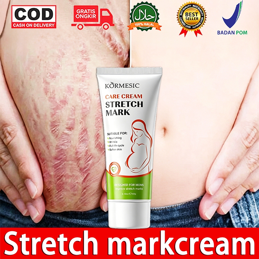 Krim Penghilang Stretch Mark Krim Stretch Mark Ori BPOM Stretch Mark Cream Penghilang Bekas Luka Kri