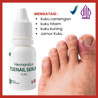 HERMORALUX Obat Tetes Atasi Kuku Cantengan Bernanah Berjamur Dan Kuning [BPOM]