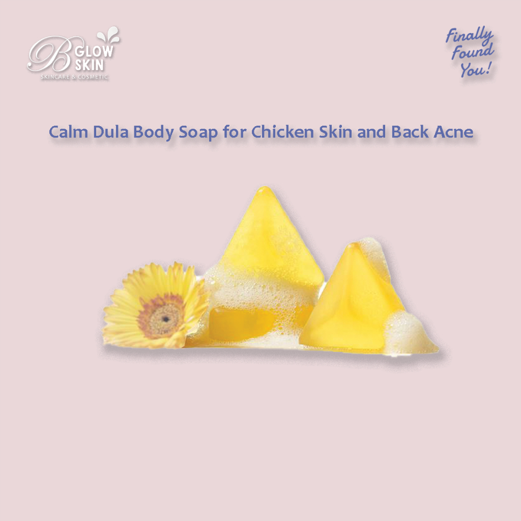 Calm Dula Body Soap for Chicken Skin and Back Acne
