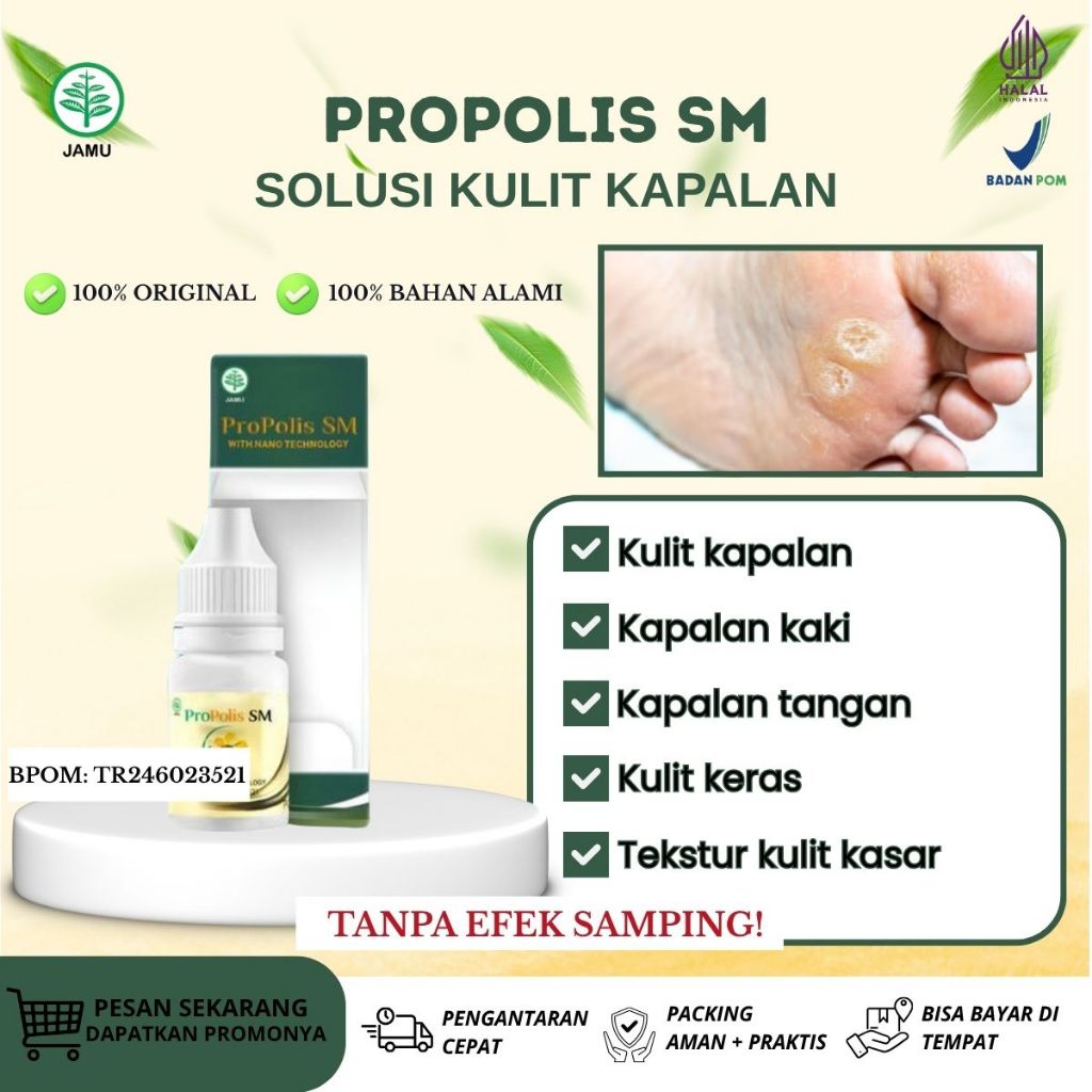 Obat Telapak Kaki Kapalan, Kapalan Di Kaki Sakit, Kapalan Menyebar, Kulit Kasar dan Kulit Kering, Ku