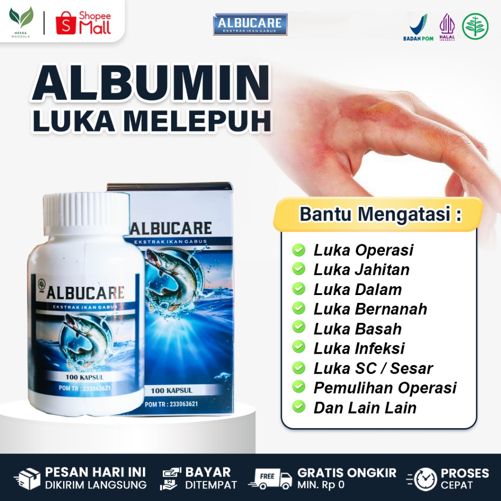 ALBUCARE Obat Pengering Luka Bakar Melepuh Luka Bakar Knalpot Kena Air Panas Minyak Panas
