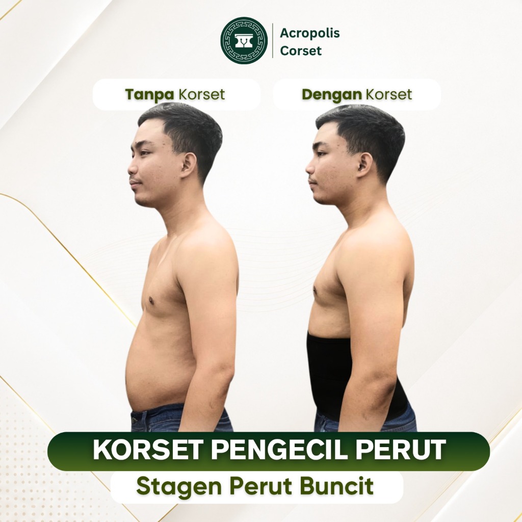 Stagen / Korset Pria / Korset Laki Laki / Pengecil Perut /  Pelangsing Buncit
