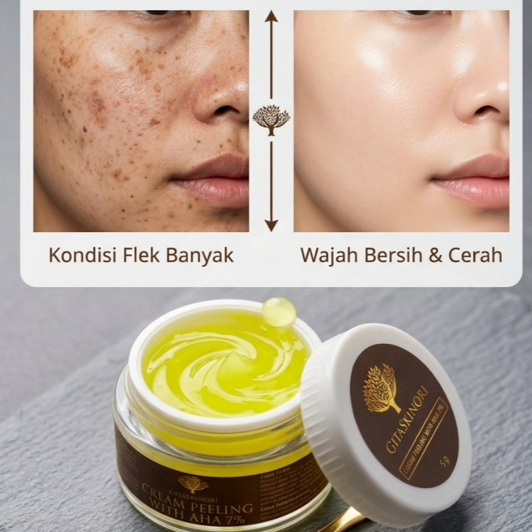 BPOM CREAM PEELING 7% KELUPAS CREAM KELUPAS MALAM CREAM KINCLONG / CREAM KELUPAS FLEK HITAM TEBAL ME