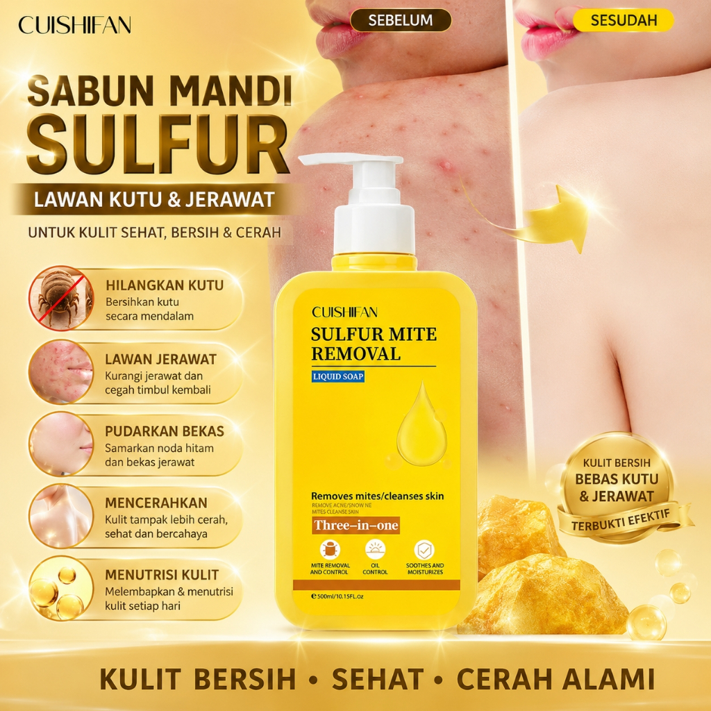 300ml Sabun Sulfur Cair Sabun Gatal Sulfur Sabun Penghilang Tungau Sabun Cair Belerang Basmi tungau 