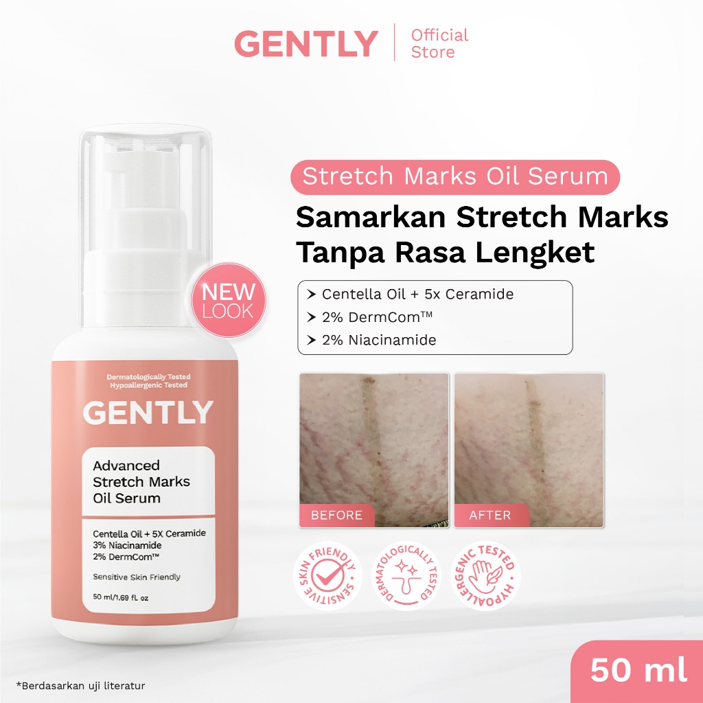 GENTLY Advanced Stretch Marks Oil Serum | Arnica Oil + 5x Ceramide + Magnolia Extract + 3% Niacinami