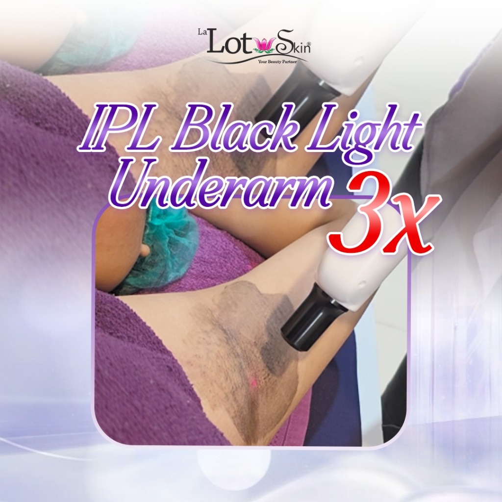 IPL BLACK LIGHT UNDERARM 3X