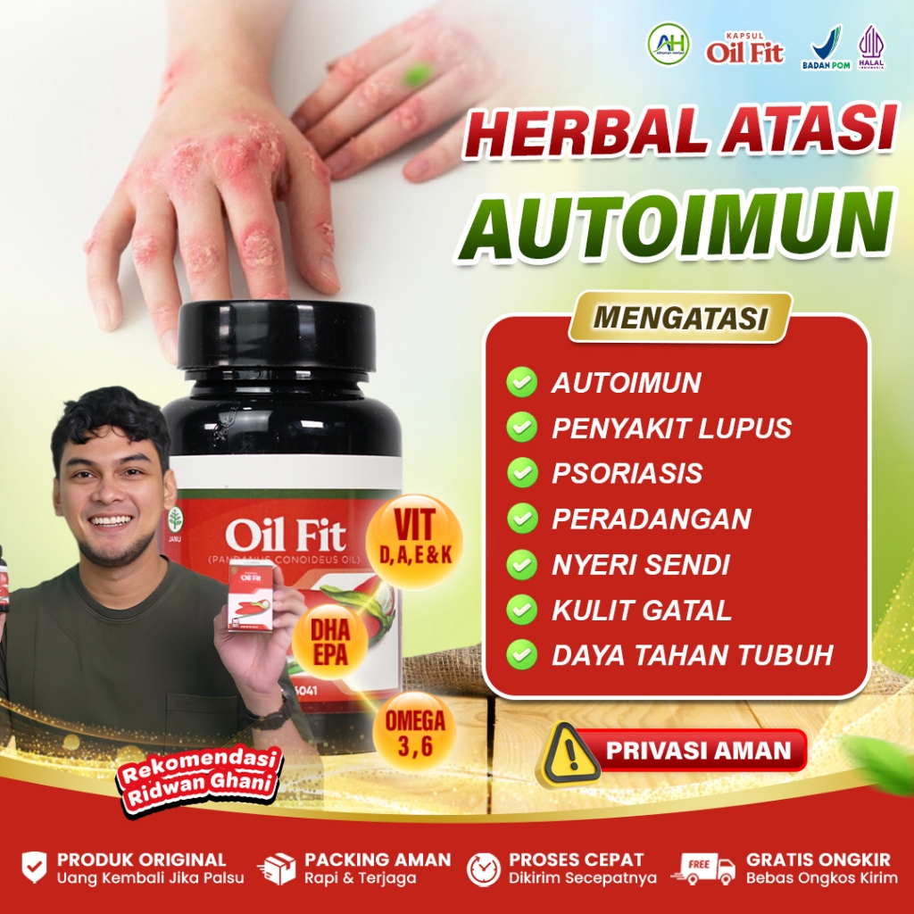 Obat Autoimun Lupus Psoriasis Nyeri Radang Sendi Gatal Biduran Alergi - Herbal Oil Fit 50 Kapsul