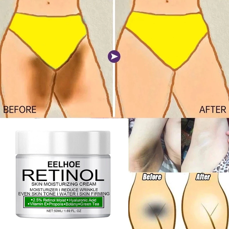 Pemutih Selangkangan Krim Pemutih Ketiak Vagina PembersihSelangkangan Hitam Krim Pemutih KetiakPemut