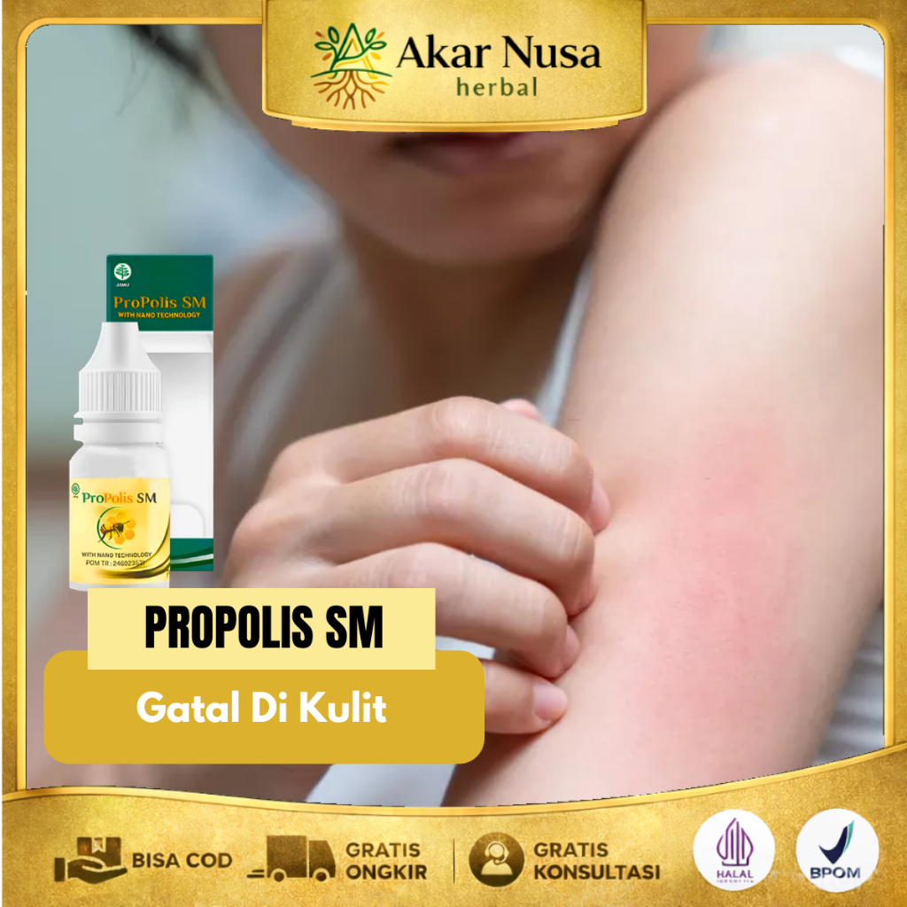 Obat Gatal Kulit Obat Gatal Di Tangan Obat Eksim Basah Dan Kering - Propolis SM