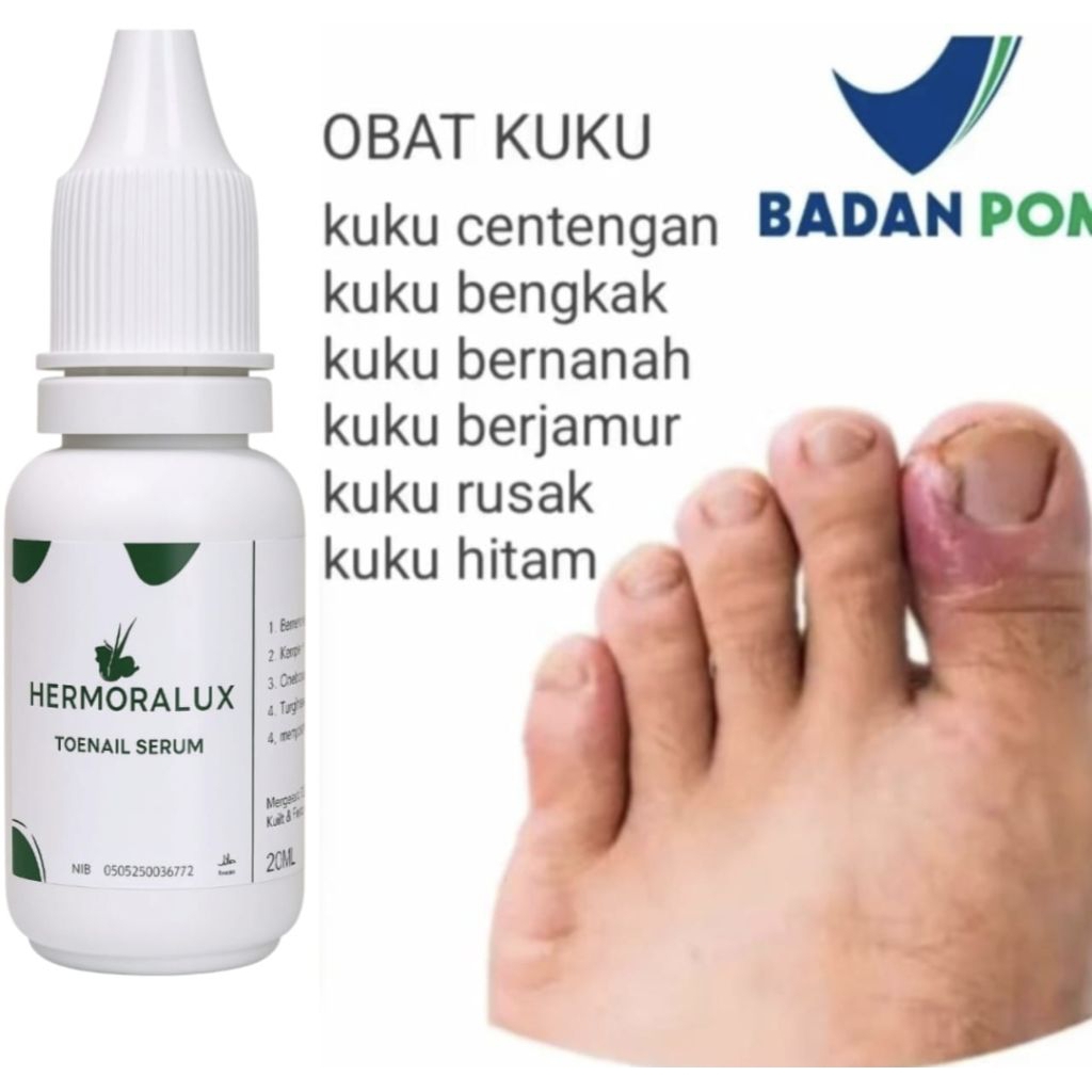 HERMORALUX SERUM PERAWATAN KUKU BERJAMUR BERNANAH RUSAK TANGAN KAKI