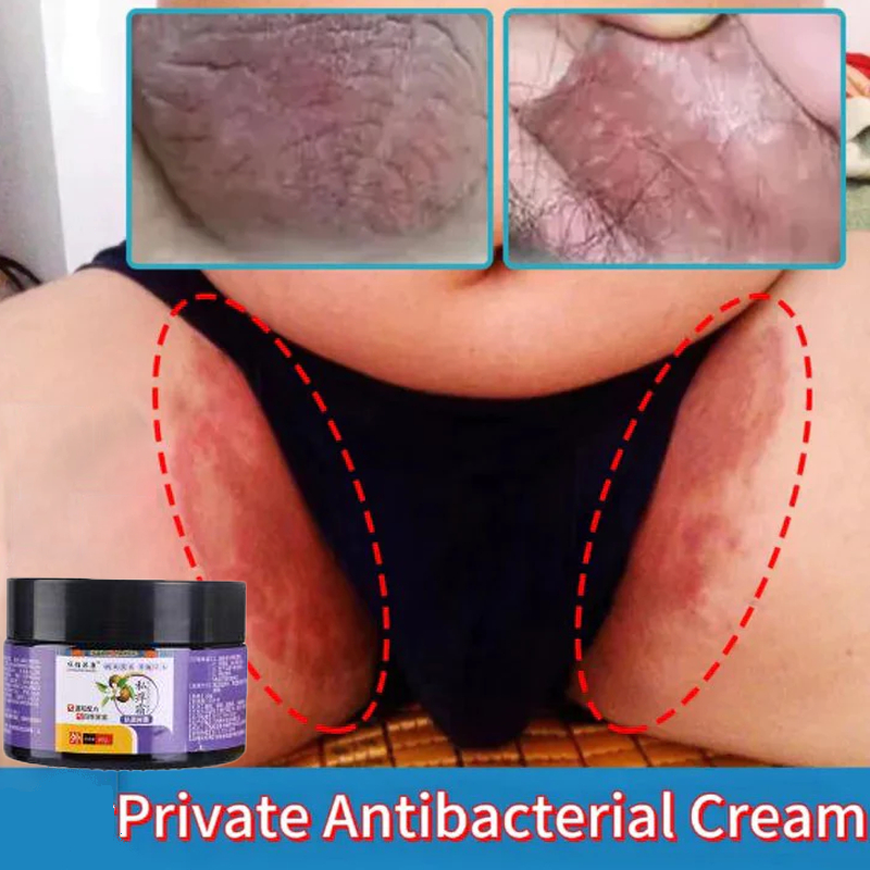 oba gatal paling ampuh salep cina gatal paling ampuh salep china gatal paling ampuhsalep jamur kulit