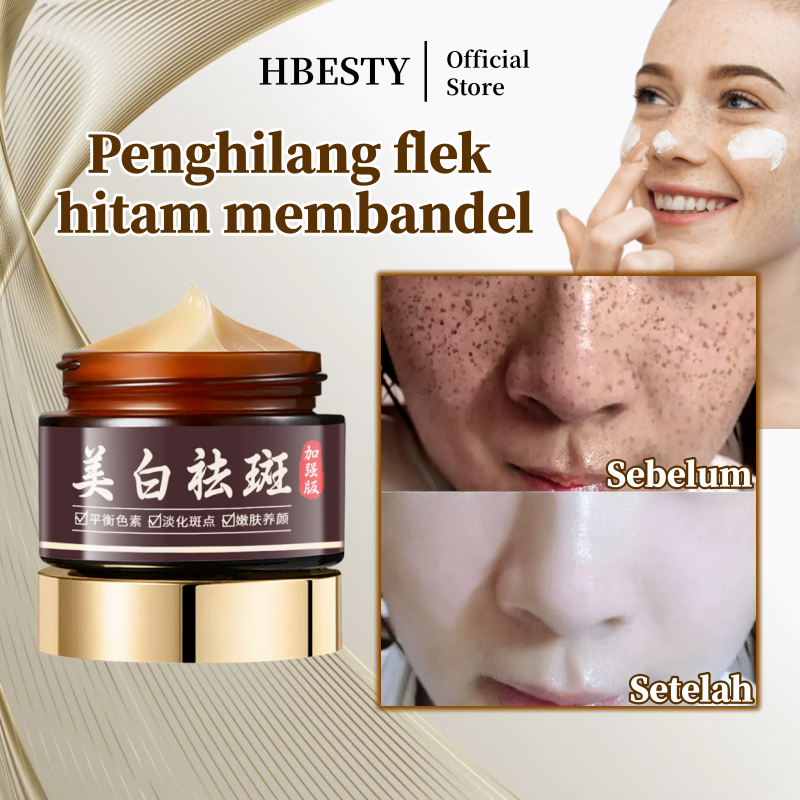 HBESTY Cream penghilang flek hitam Cream flek hitam membandel Menghilangkan flek hitam di wajah Dark