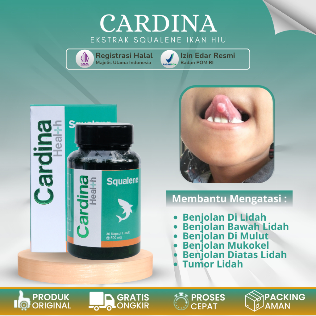 Obat Penghilang Benjolan Di Lidah, Benjolan Di Bawah Lidah, Benjolan Di Ujung Lidah, Benjolan Di Pan